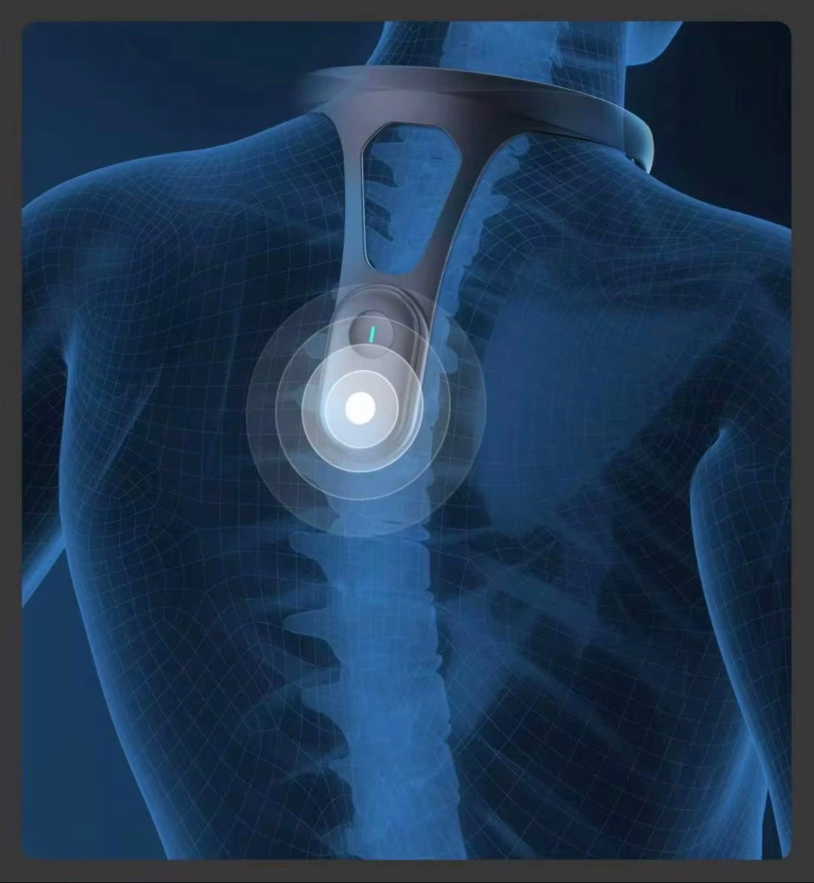 Digital illustration of a pacemaker within a human chest on an X-ray background